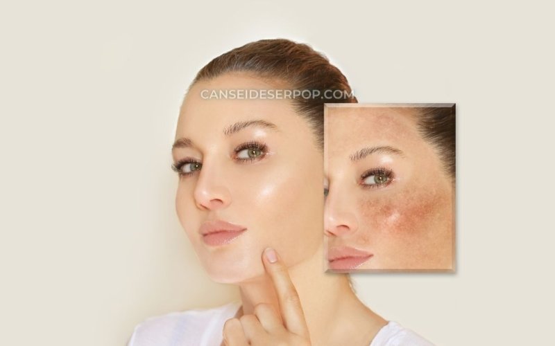 Cuidados para evitar manchas de sol na pele